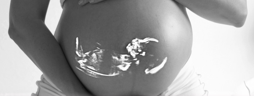 Dona i Nen ESTUDIO DE ADN FETAL MEDIANTE SANGRE MATERNA