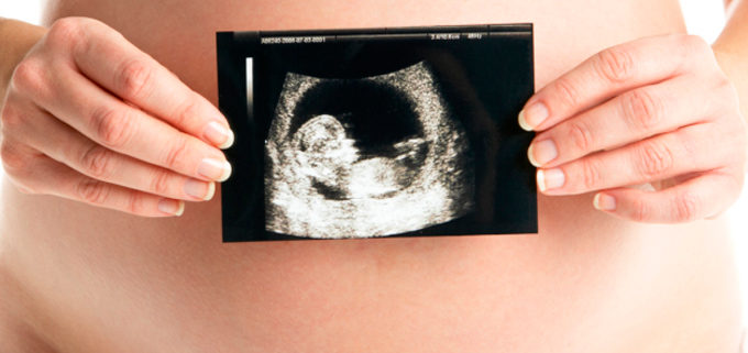 pruebas diagnostico prenatal